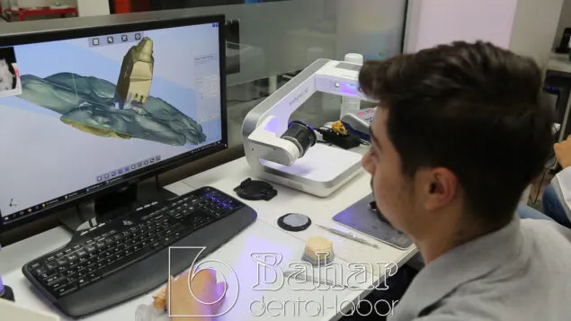 Altyapı Diş Protezler İstanbul