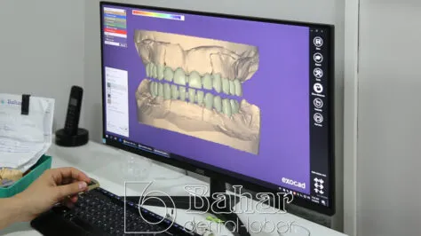 Altyapı Diş Protezler İstanbul
