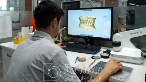 Altyapı Diş Protezler