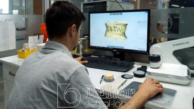 Altyapı Diş Protezler