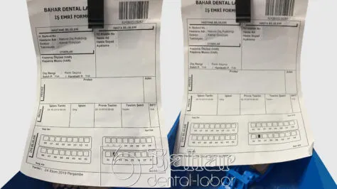 Diş laboratuvarı İstanbul