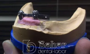 Barlı Protez (CAD/CAM) Protez Üretimi