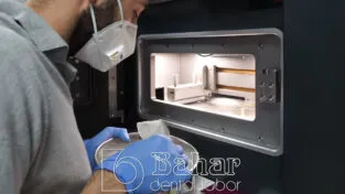 CNC Diş Protezler İstanbul