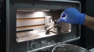 CNC Diş Protezler İstanbul