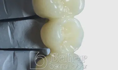 Multilayer Zirkonyum - bahar dental