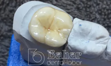 Multilayer Zirkonyum diş protez laboratuvarı