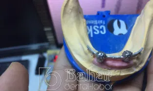 Barlı Protez (CAD/CAM) Ифрфк Вутефд