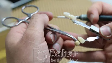 Poselen Diş Kaplama Laboratuvarı