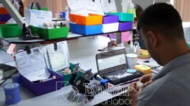 Poselen Diş Kaplama Laboratuvarı