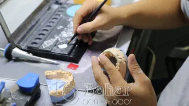 Poselen Diş Kaplama Laboratuvarı