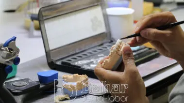 Poselen Diş Kaplama Laboratuvarı