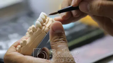 Poselen Diş Kaplama Laboratuvarı