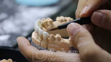 Poselen Diş Kaplama Laboratuvarı