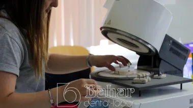 Poselen Diş Kaplama Laboratuvarı