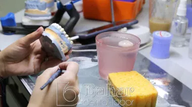 Poselen Diş Kaplama Laboratuvarı