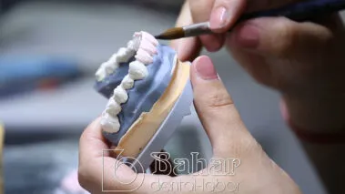 Poselen Diş Kaplama Laboratuvarı