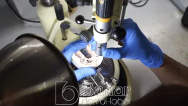 Diş Protezleri Üretimi