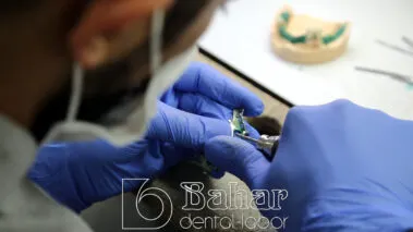 Diş Protezleri İmalatı