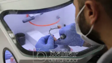 Diş Protezleri İmalatı