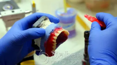 Diş Protezleri İstanbul