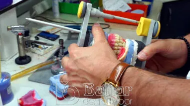 Diş Protezleri İstanbul