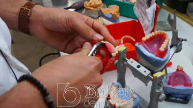 Diş Protezleri İstanbul