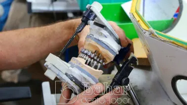 Diş Protezler Laboratuvarı