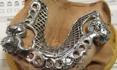 İstanbul Diş Protez üretimi