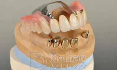 İstanbul Diş Protez üretimi