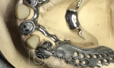 İstanbul Diş Protez imalatı