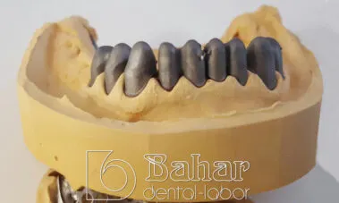 İstanbul Diş Protez üretimi