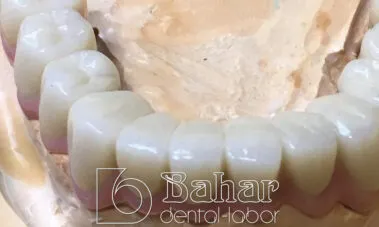 İstanbul Diş Protez imalatı