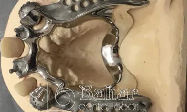 İstanbul Diş Protez imalatı