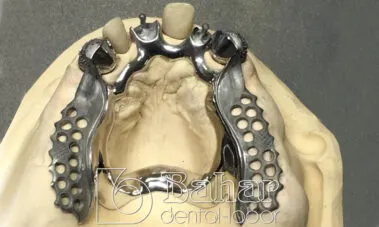 İstanbul Diş Protez üretimi