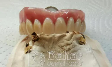 İstanbul Diş Protez üretimi