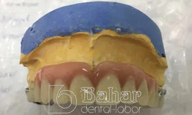 İstanbul Diş Protez üretimi