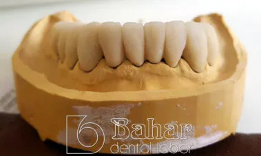 İstanbul Diş Protez imalatı