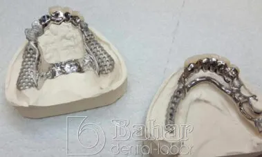 İstanbul Diş Protez üretimi