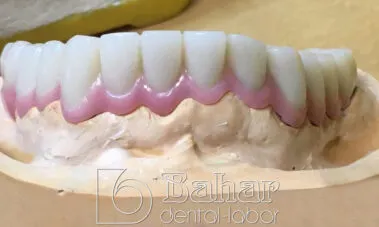 İstanbul Diş Protez üretimi