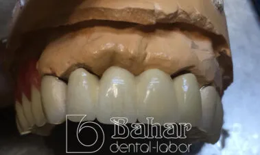 İstanbul Diş Protez üretimi