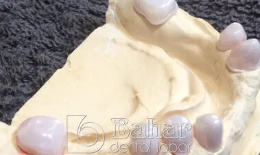 İstanbul Diş Protez imalatı