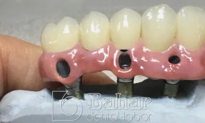 Toronto Bridge (CAD/CAM)