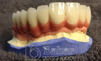 Toronto Bridge (CAD/CAM)