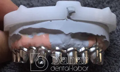 Toronto Bridge (CAD/CAM)