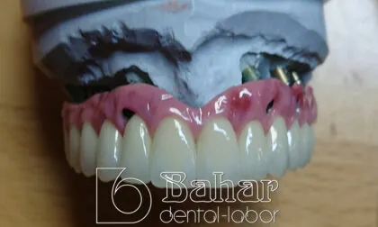 Toronto Bridge (CAD/CAM) istanbul