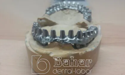 Toronto Bridge (CAD/CAM) bahar dental