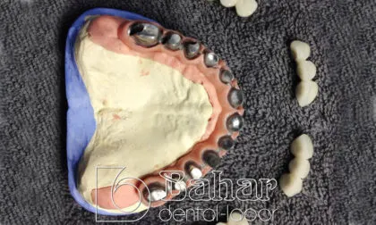 Toronto Bridge (CAD/CAM)