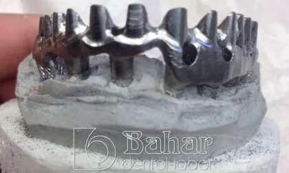 Toronto Bridge (CAD/CAM) diş laboratuvarı