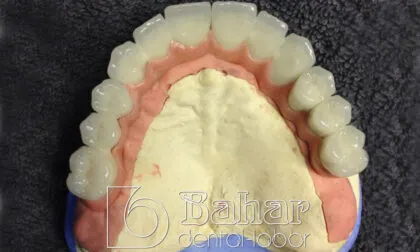 Toronto Bridge (CAD/CAM) diş laboratuvarı