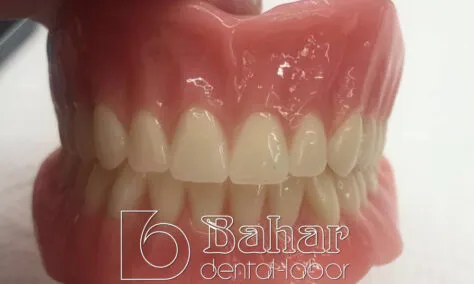 Total Protez (CAD/CAM) diş protezleri